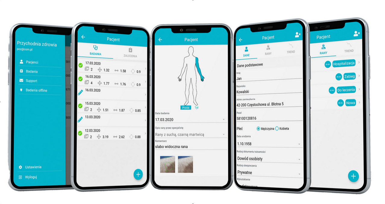 Ekrany smartfonów prezentujące aplikację medyczną z interfejsem do zarządzania danymi pacjentów, w tym wynikami badań, historią ran i danymi osobowymi, z zaznaczoną lokalizacją rany na schemacie...