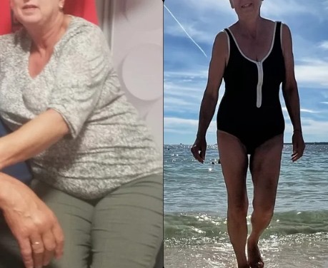 Kobieta przed i po utracie wagi. Po lewej stronie w ubraniu, po prawej w stroju kąpielowym na plaży. Widoczna różnica w sylwetce.