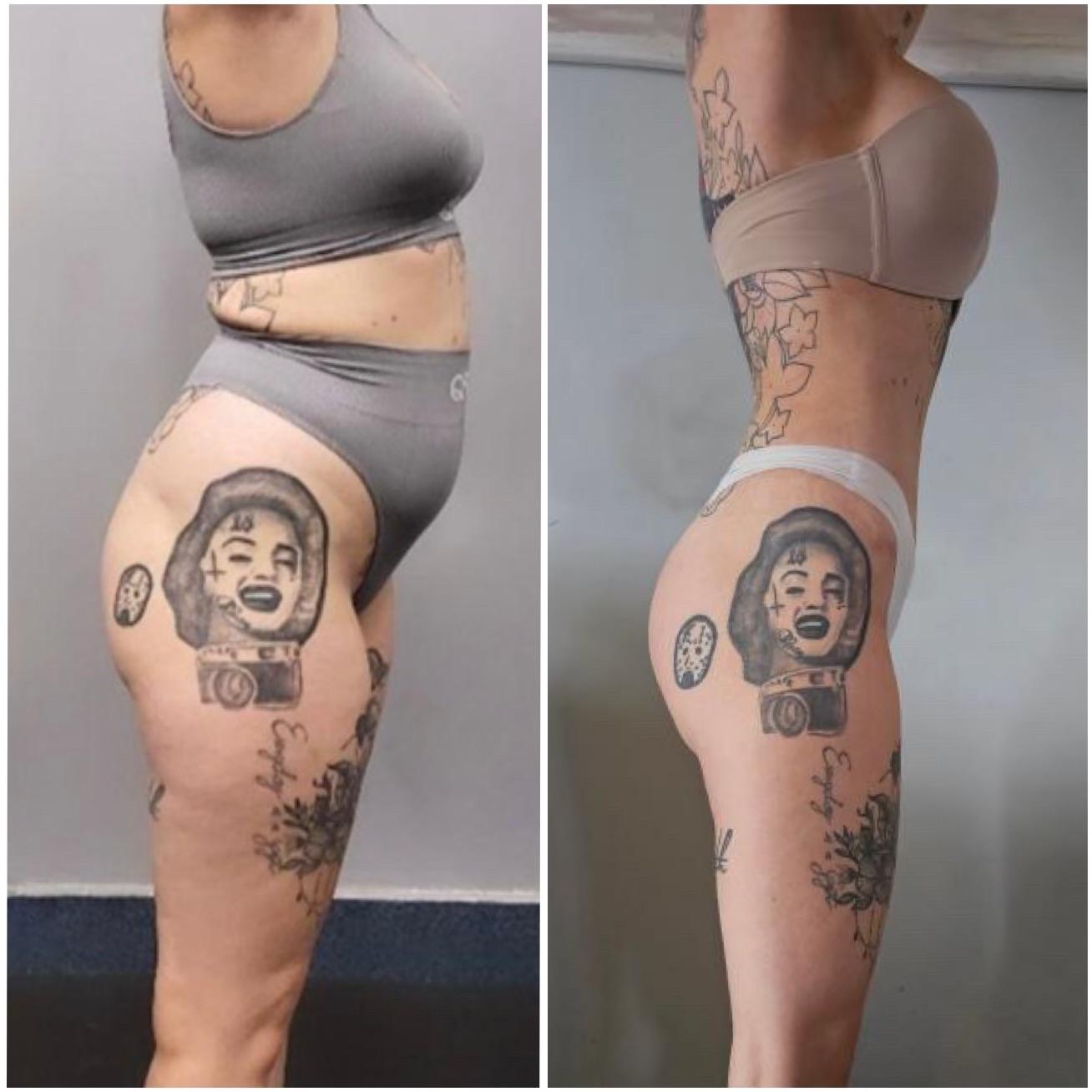 Porównanie sylwetki kobiety przed i po, widoczne zmiany w talii i pośladkach, z tatuażami na udach, na szarym tle. Zdjęcie profilowe, ukazujące efekty transformacji.