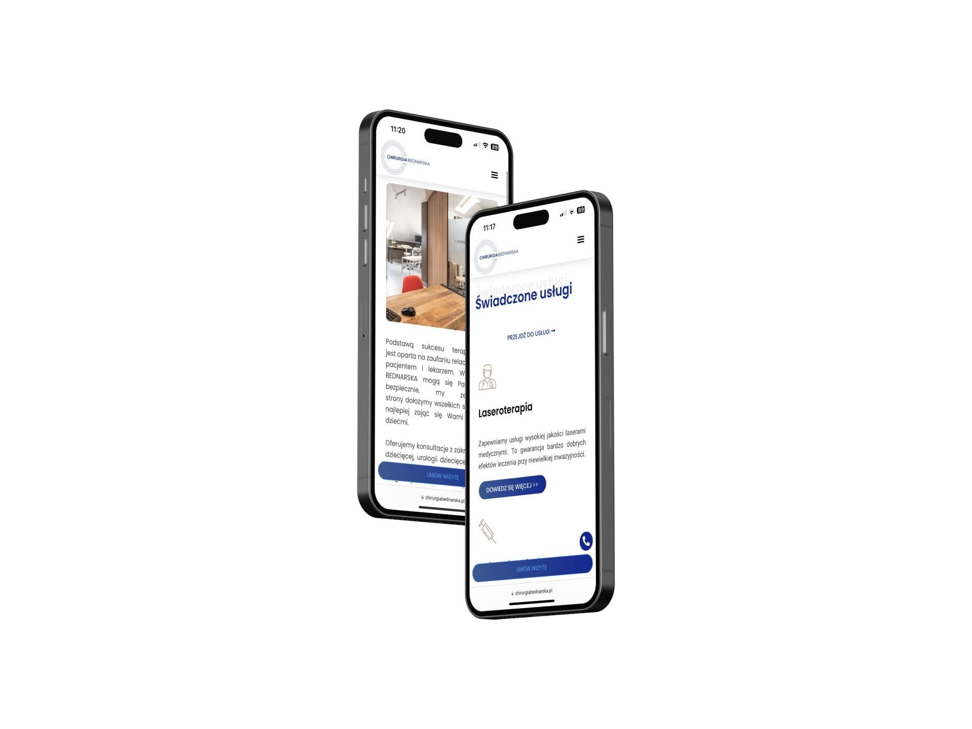 Dwa telefony prezentujące stronę internetową kliniki chirurgii dziecięcej z ofertą laseroterapii, widoczne menu i przyciski CTA.