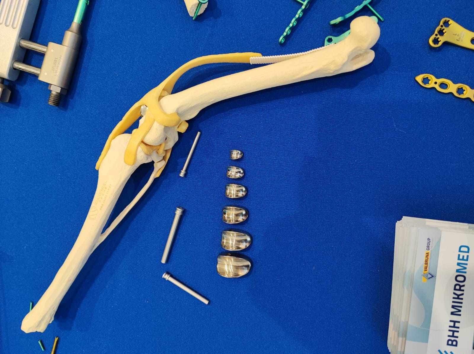 Model kości z elementami mocującymi, śrubami i narzędziem na niebieskim tle, prezentacja firmy BHH Mikromed.