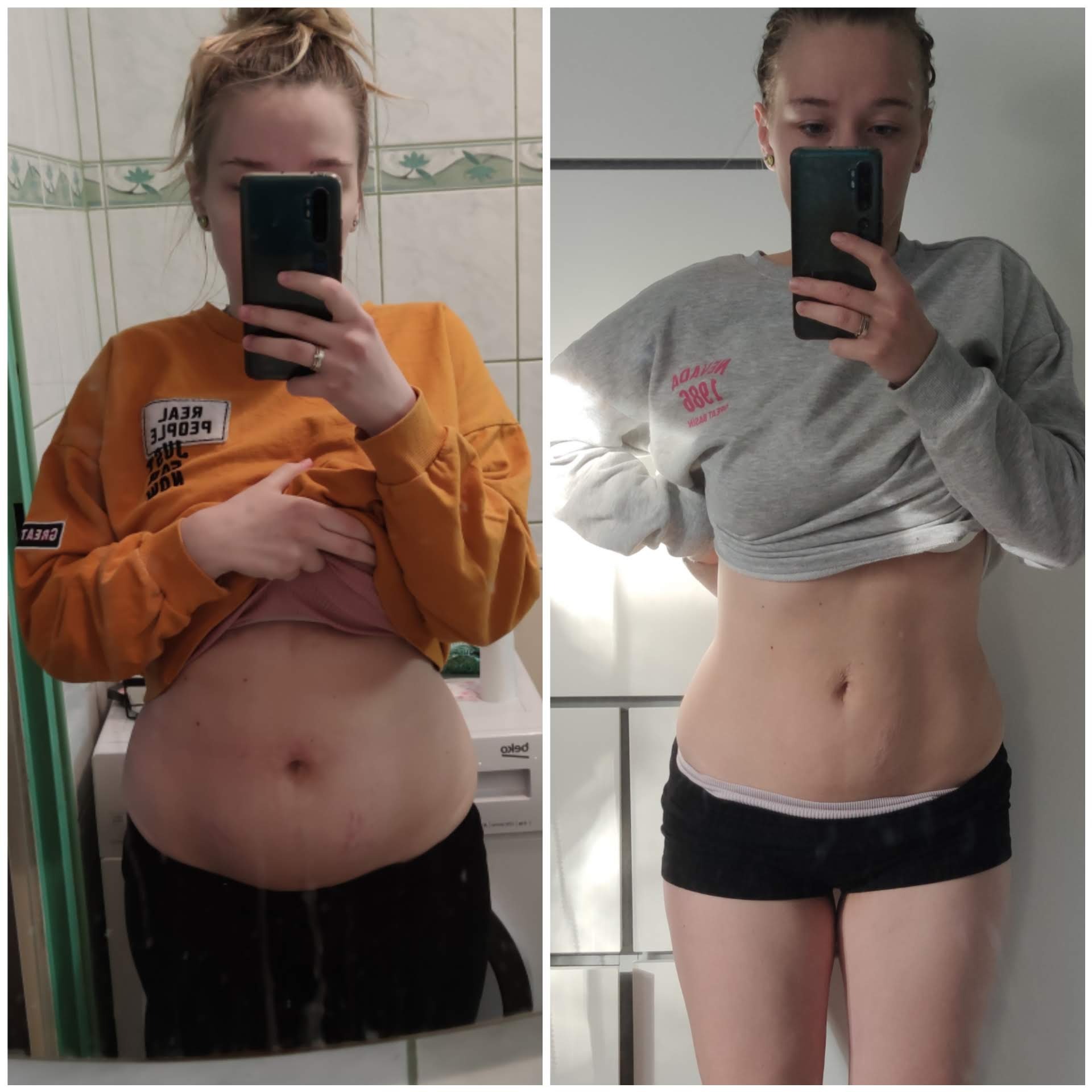 Kolaż przedstawiający porównanie sylwetki kobiety przed i po diecie lub treningu, z widoczną różnicą w obwodzie brzucha.