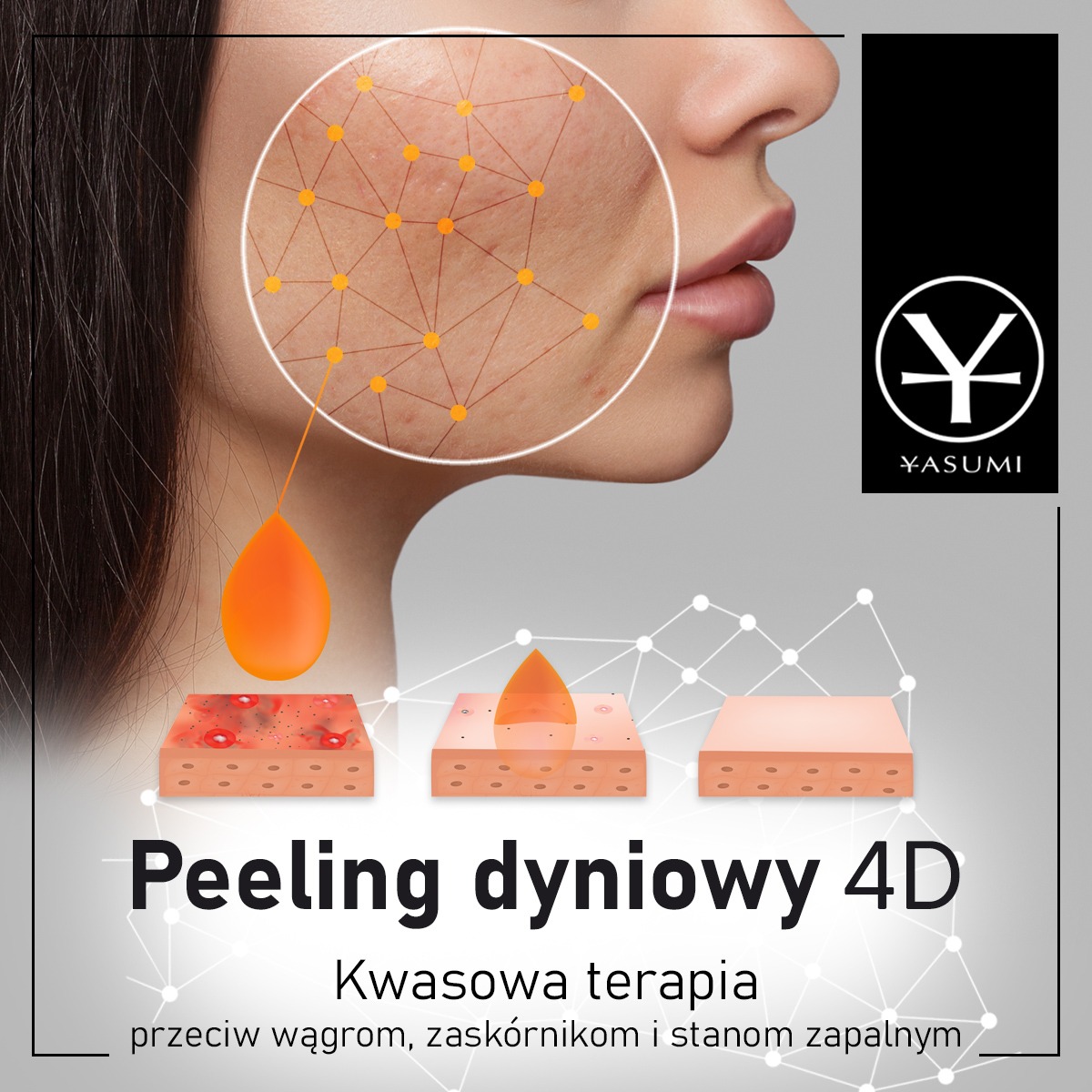 Grafika reklamowa peelingu dyniowego 4D z wizualizacją efektów na skórze twarzy, z zaznaczonym obszarem problematycznym i transformacją po zabiegu, obok logo Yasumi.