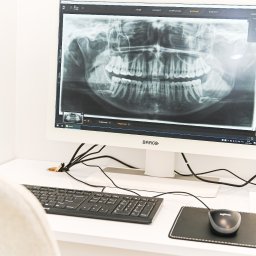 Pracownia RTG na miejscu. Poznań, Polanka.