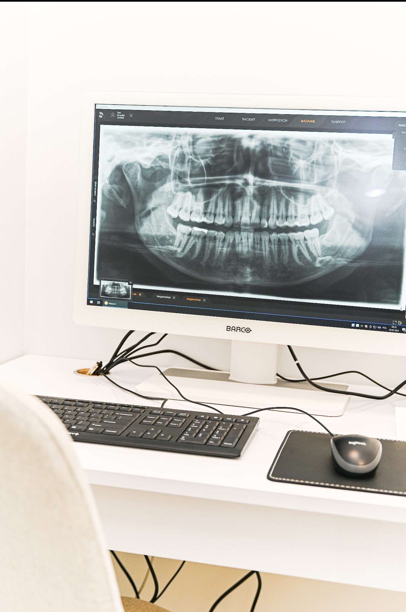 Pracownia RTG na miejscu. Poznań, Polanka.