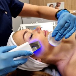 Perfect Look Clinic Głogów - Kobieta podczas zabiegu oczyszczania twarzy ultradźwiękami; widoczna głowica urządzenia emitująca niebieskie światło oraz dłonie kosmetyczki w niebieskich rękawiczkach, trzymające wacik.