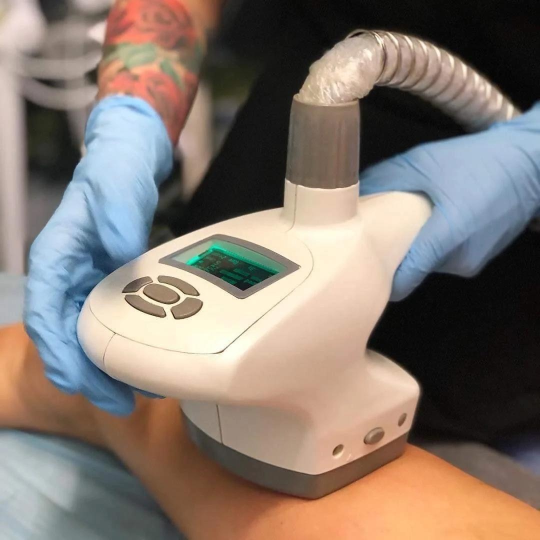 Urządzenie do modelowania sylwetki w trakcie zabiegu na nodze, widoczny wyświetlacz z zielonymi danymi i ramię osoby wykonującej zabieg w niebieskiej rękawiczce.