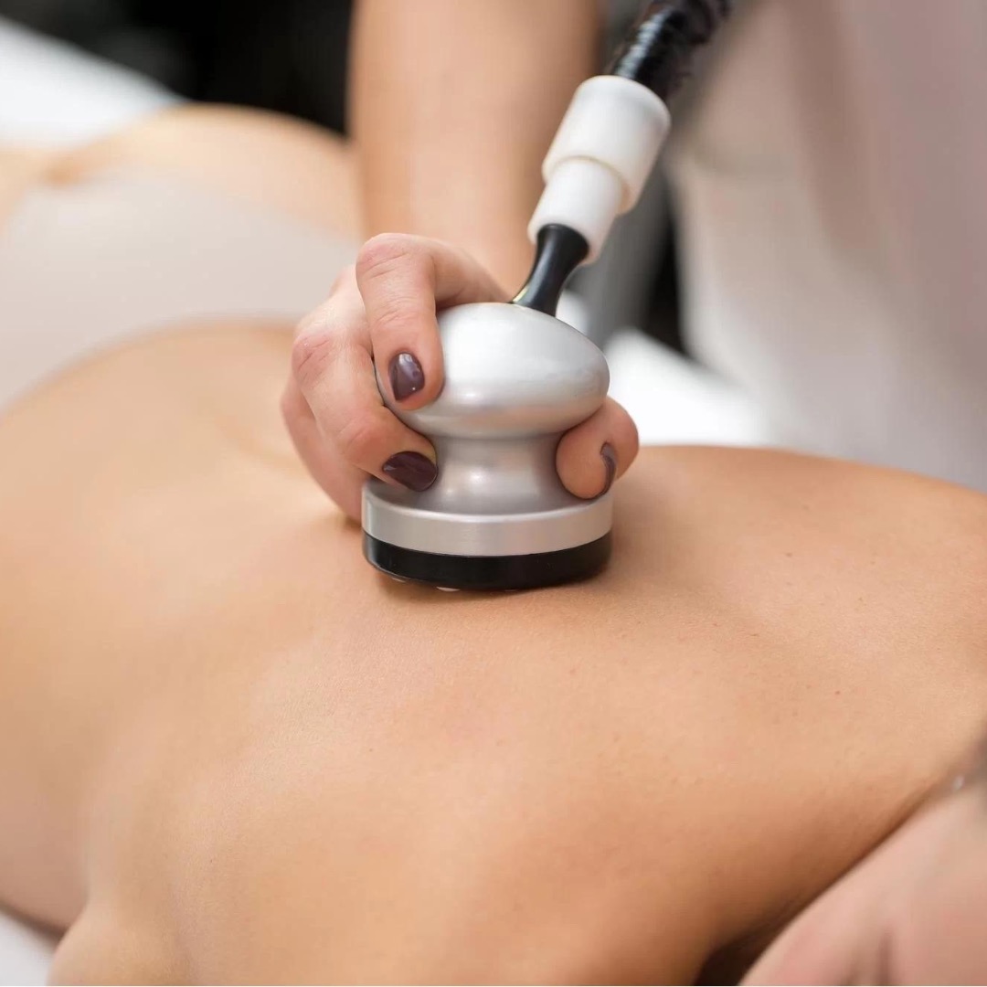 Masaż próżniowy pleców wykonywany urządzeniem z metalową głowicą i czarnym wężem, dłoń z ciemnym manicure przytrzymuje urządzenie.