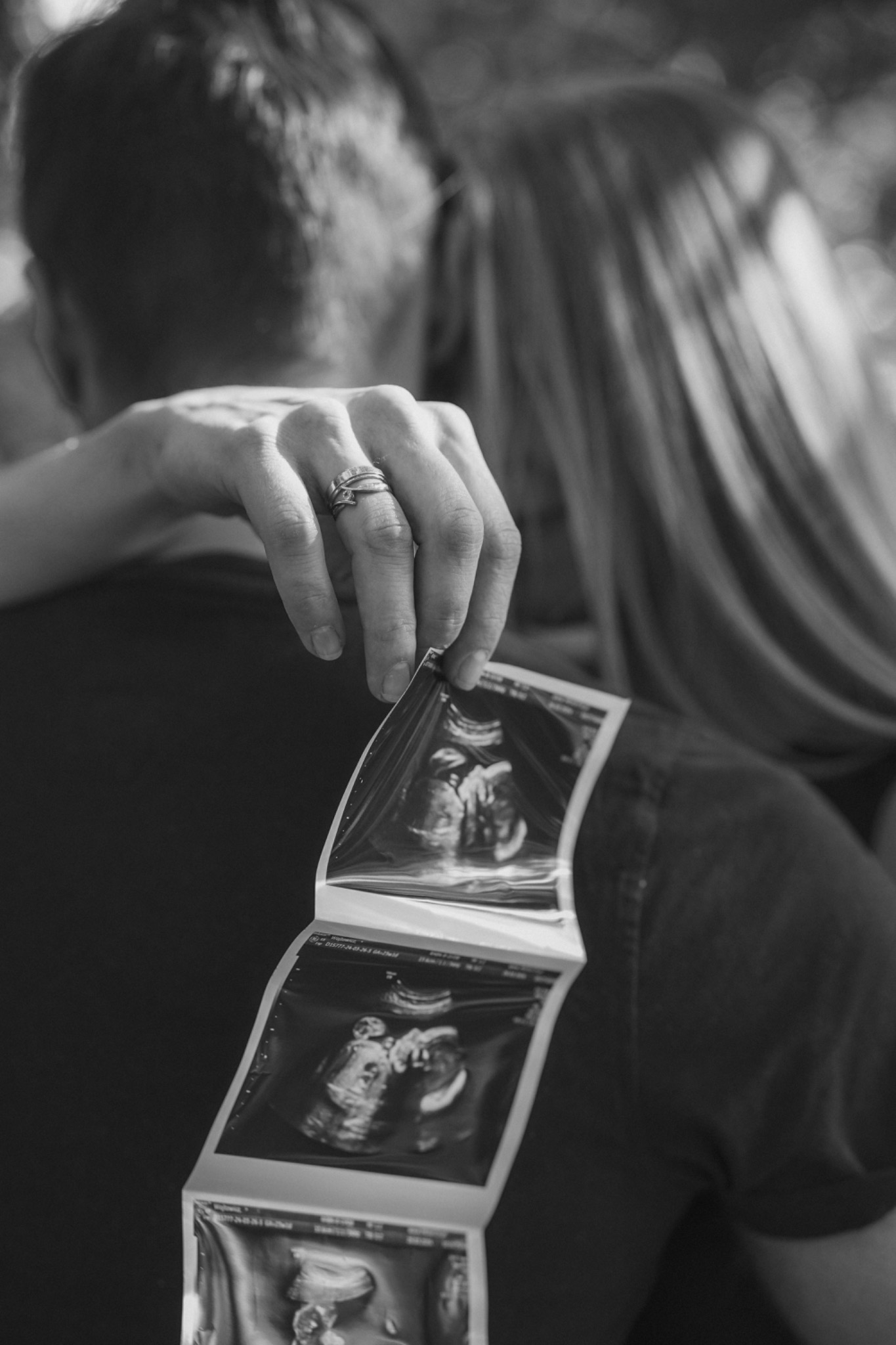 Czarno-białe zdjęcie pary obejmującej się, trzymającej serię zdjęć USG w dłoni z widocznymi obrączkami.