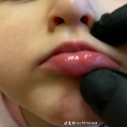 Zbliżenie na usta dziecka podczas badania przez osobę w czarnych rękawiczkach.