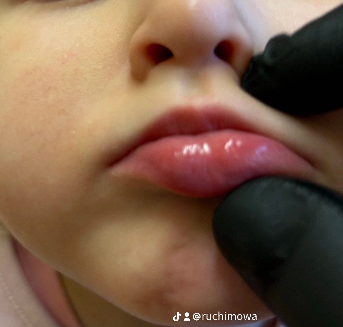 Zbliżenie na usta dziecka podczas badania przez osobę w czarnych rękawiczkach.