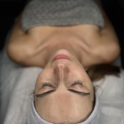 NATURAL SKIN CLINIC - salon kosmetyczny Kraków - Kobieta leżąca na stole zabiegowym z opaską na włosach i zakrytymi ramionami ręcznikiem, widok z góry na twarz przed zabiegiem kosmetycznym.