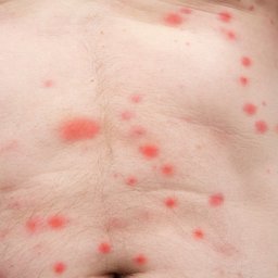 Dezynsekcja i deratyzacja Wrocław 2