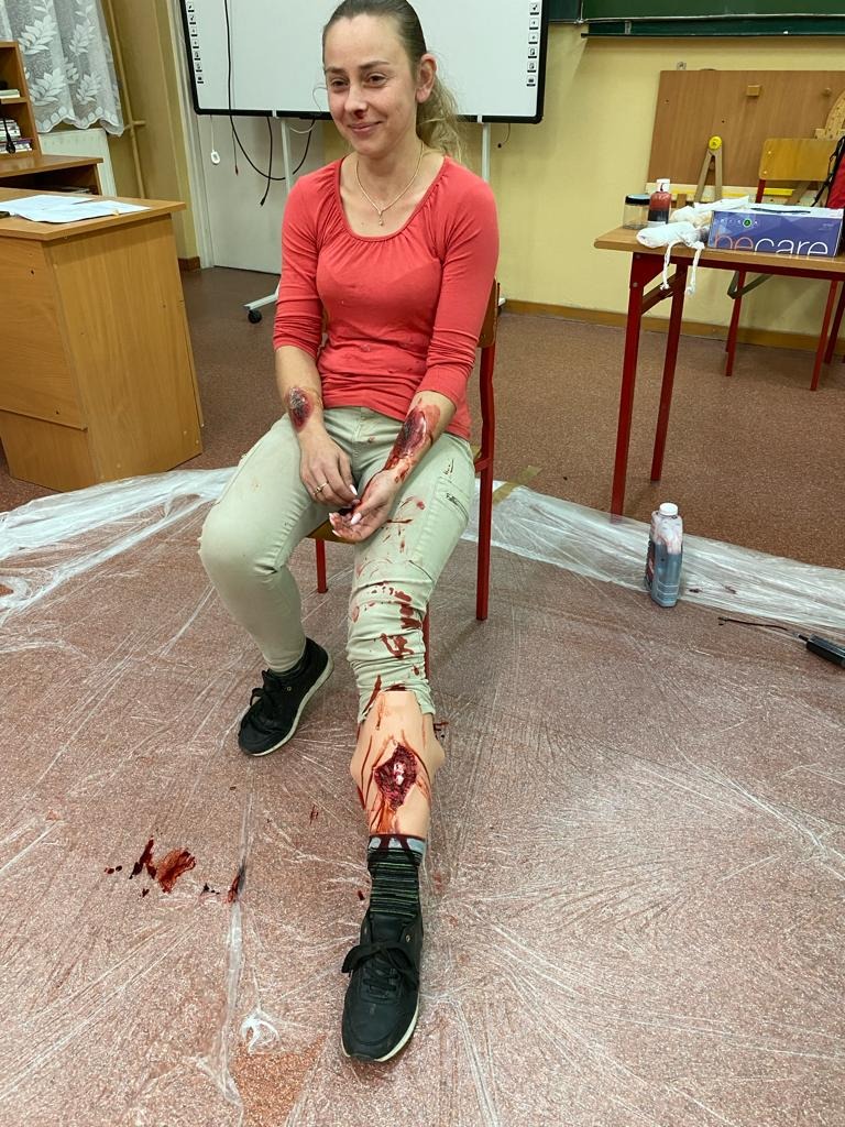 Kobieta siedzi na krześle z realistycznymi symulacjami ran na ramionach i nodze podczas pozorowanego urazu, prawdopodobnie w trakcie demonstracji udzielania pierwszej pomocy.