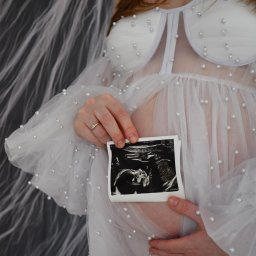 FotoArtNyk - Kobieta w białej, prześwitującej sukience z perłami, trzymająca zdjęcie USG brzucha w dłoni z pierścionkiem.