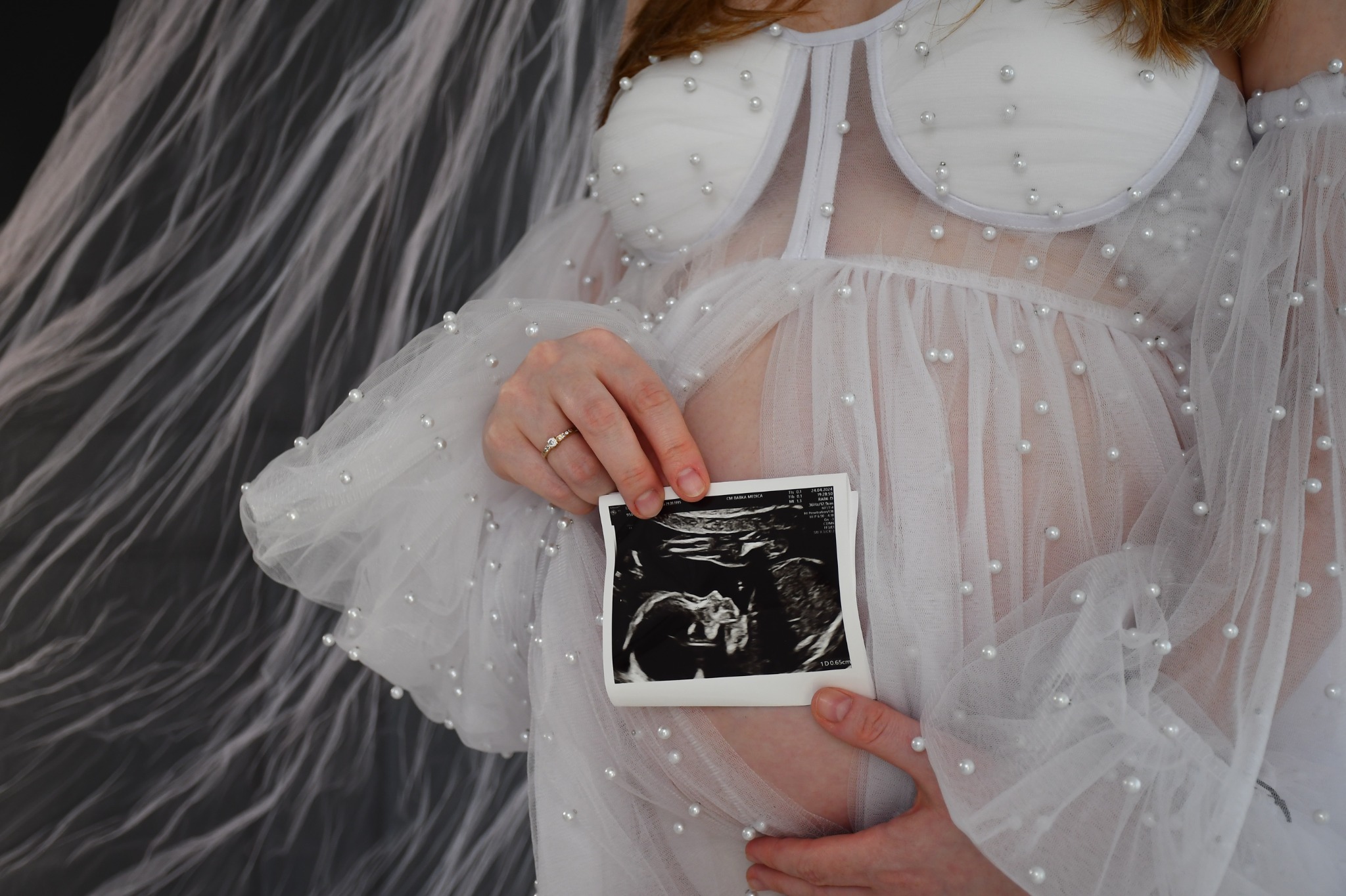 Kobieta w białej, prześwitującej sukience z perłami, trzymająca zdjęcie USG brzucha w dłoni z pierścionkiem.