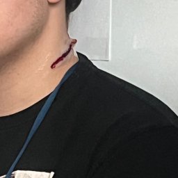 Kurs pierwszej pomocy Bielsko-Biała 2