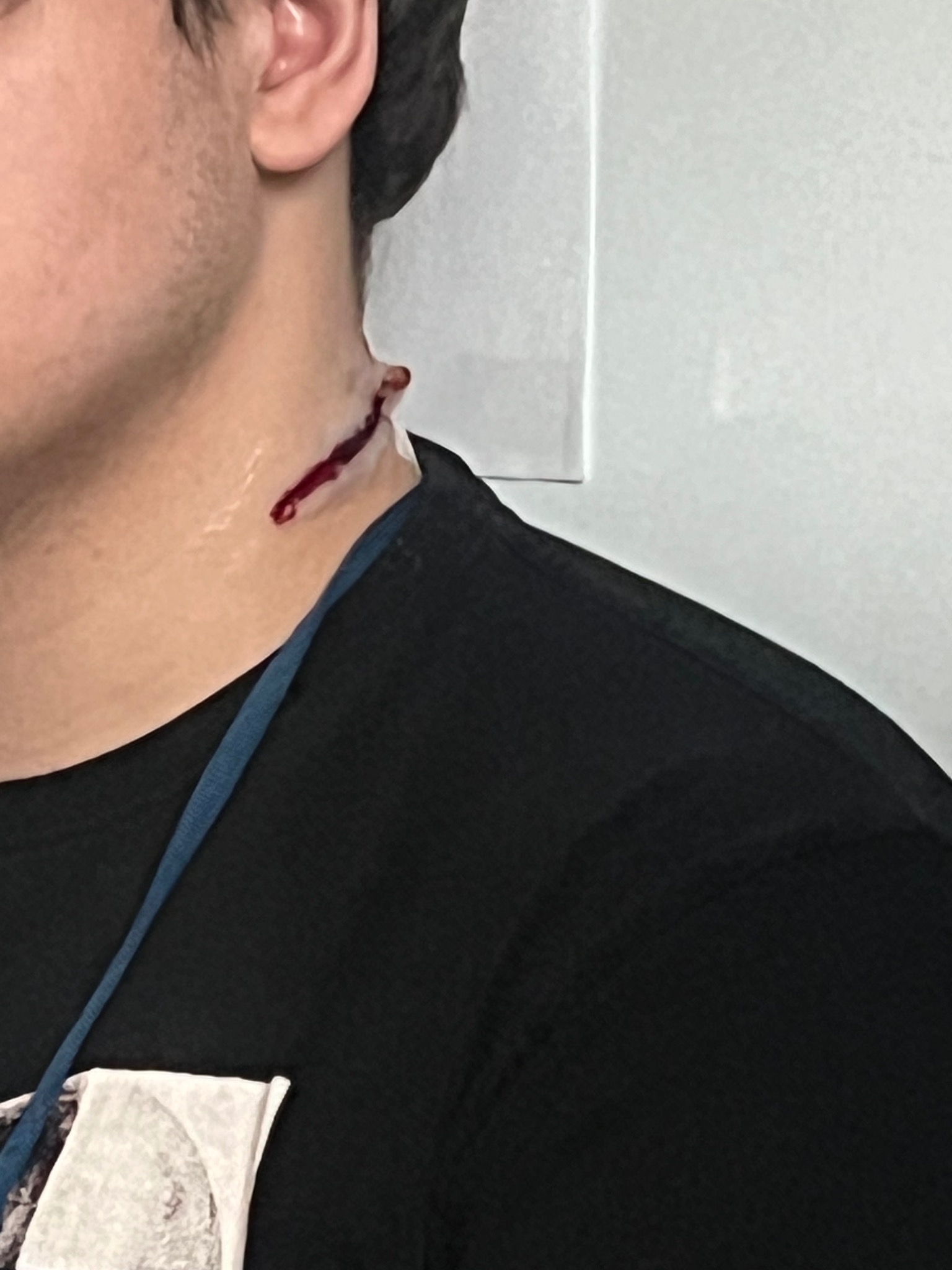 Osoba z realistyczną raną na szyi, prawdopodobnie charakteryzacja do kursu pierwszej pomocy. Widoczna krew i imitacja uszkodzonej skóry.
