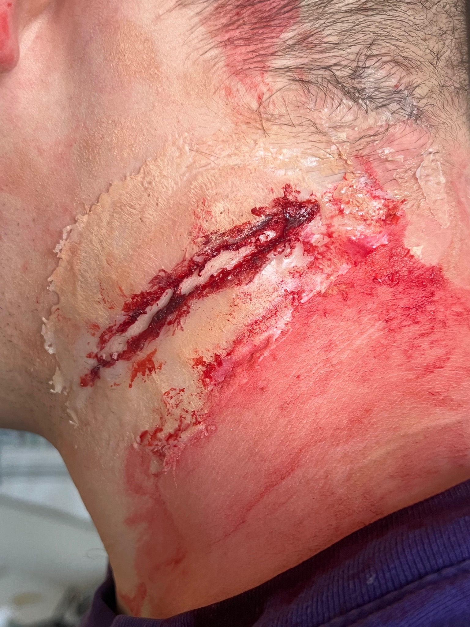 Realistyczna charakteryzacja rany ciętej na szyi z użyciem sztucznej krwi i lateksu, fragment głowy w kadrze, widoczne włosy i fragment ubrania.