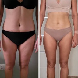 Trener personalny Wrocław Marcin Czarnecki - Zdjęcie typu 'przed i po' przedstawiające sylwetkę kobiety w bieliźnie, z widoczną redukcją cellulitu i poprawą jędrności skóry na udach i brzuchu.