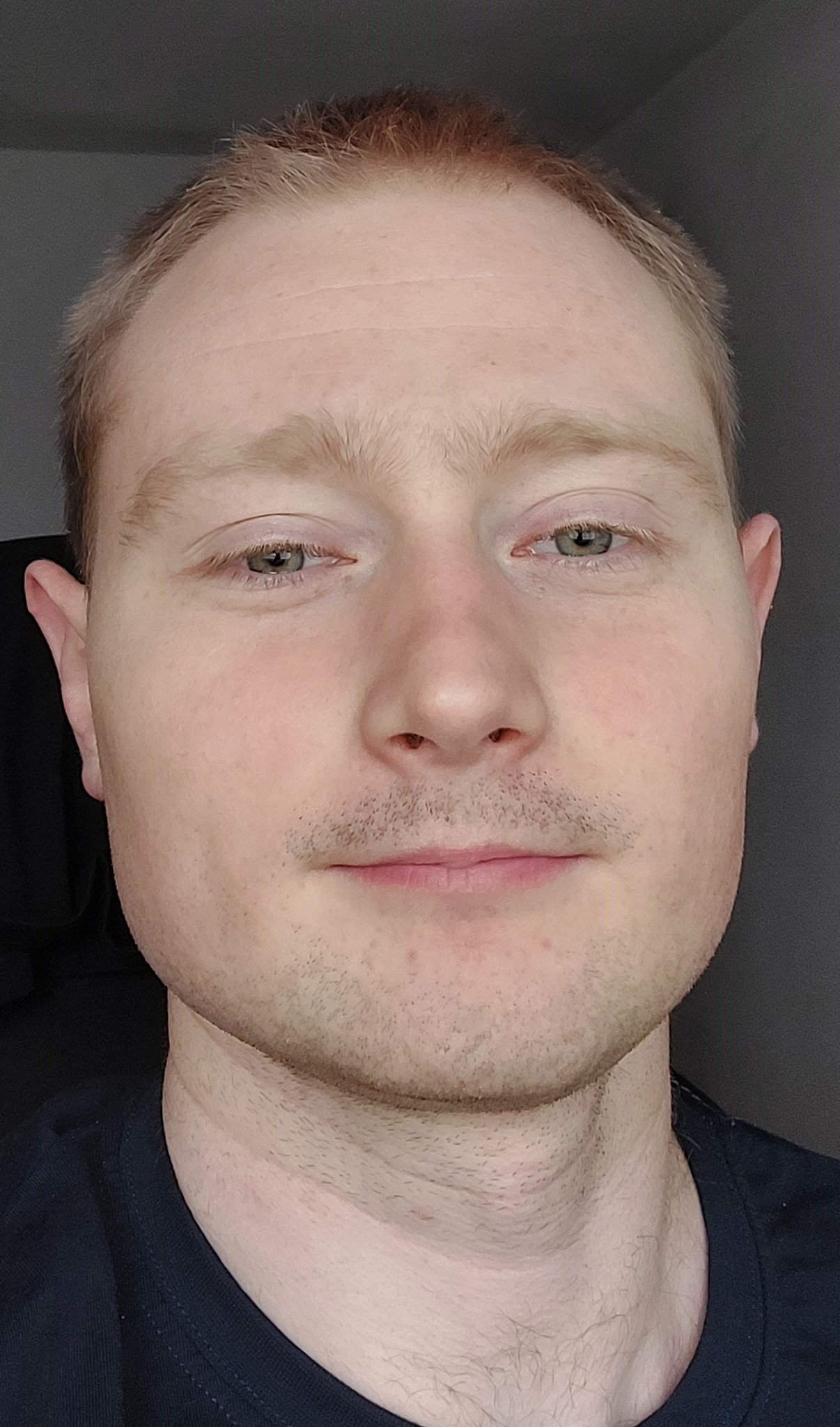 Portret mężczyzny z bliska, z lekkim zarostem i zaczerwienieniem na szyi, na tle ciemnej ściany.