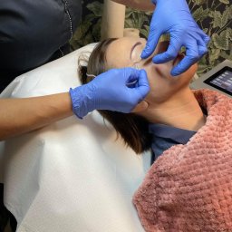 Karboksyterapia w salonie BeBeauty Inflancka 27, Poznań