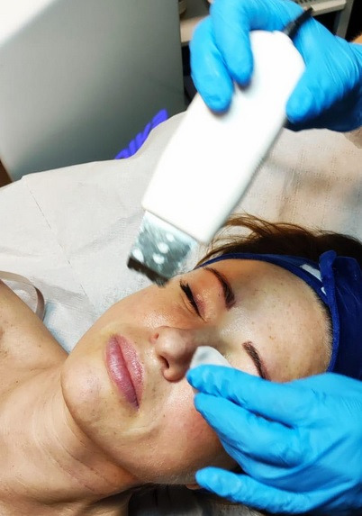 Peeling kawitacyjny w Salonie BeBeauty Inflancka 27, Poznań