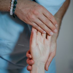 Magic Therapies Gabinet Medycyny Naturalnej - Cienka igła wkłuta w dłoń pacjenta, widoczne dłonie terapeuty w niebieskim uniformie z piórem w kieszeni, bransoletki na nadgarstku terapeuty i mały tatuaż na nadgarstku pacjenta.