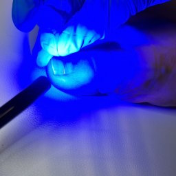 Twój Podolog Dorota Niedźwiedź klamra ortyneksyjna 