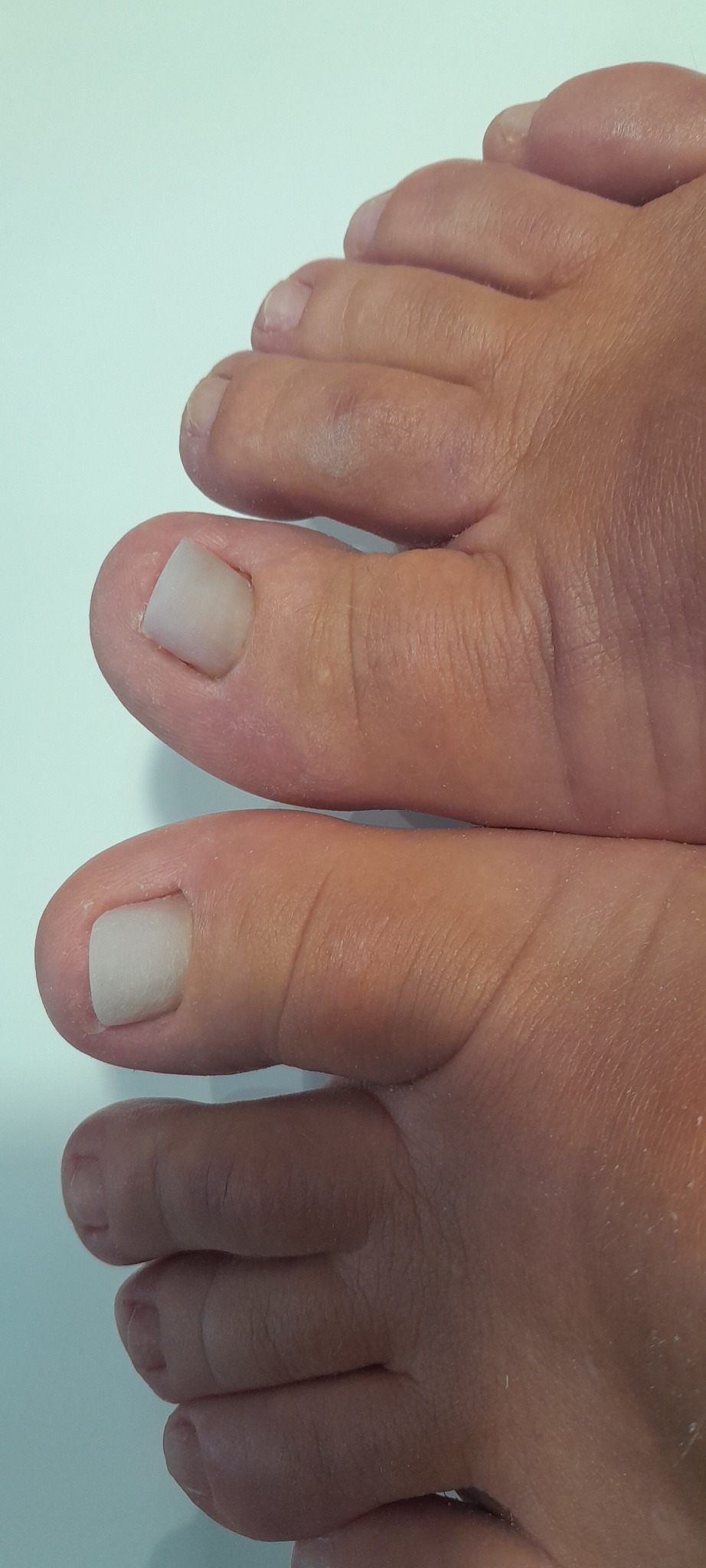 Rekonstrukcja paznokci akrylem