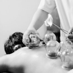 Jarosław Nemno - Czarno-białe zdjęcie: terapeuta wykonuje zabieg stawiania baniek na plecach pacjenta, używając płonącego wacika i szczypiec.
