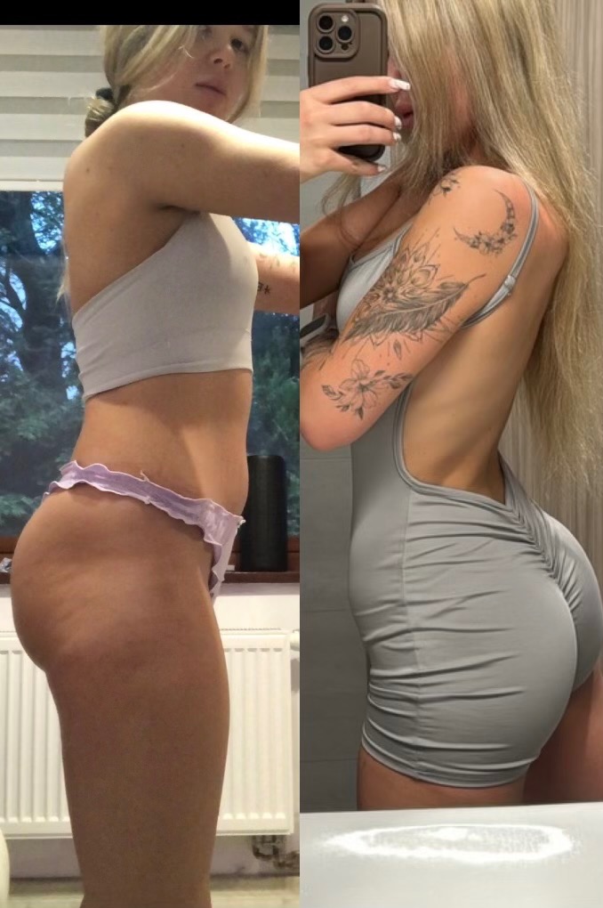 Porównanie sylwetki kobiety przed i po: po lewej stronie widoczna sylwetka przed, po prawej po, z widoczną różnicą w kształcie i jędrności ciała, dodatkowo po prawej stronie widoczny tatuaż...