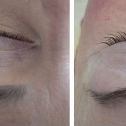 Mind & Body - Studio masażu Kobido - Porównanie oka przed i po zabiegu liftingu rzęs: widoczne wydłużone i podkręcone rzęsy po prawej stronie.