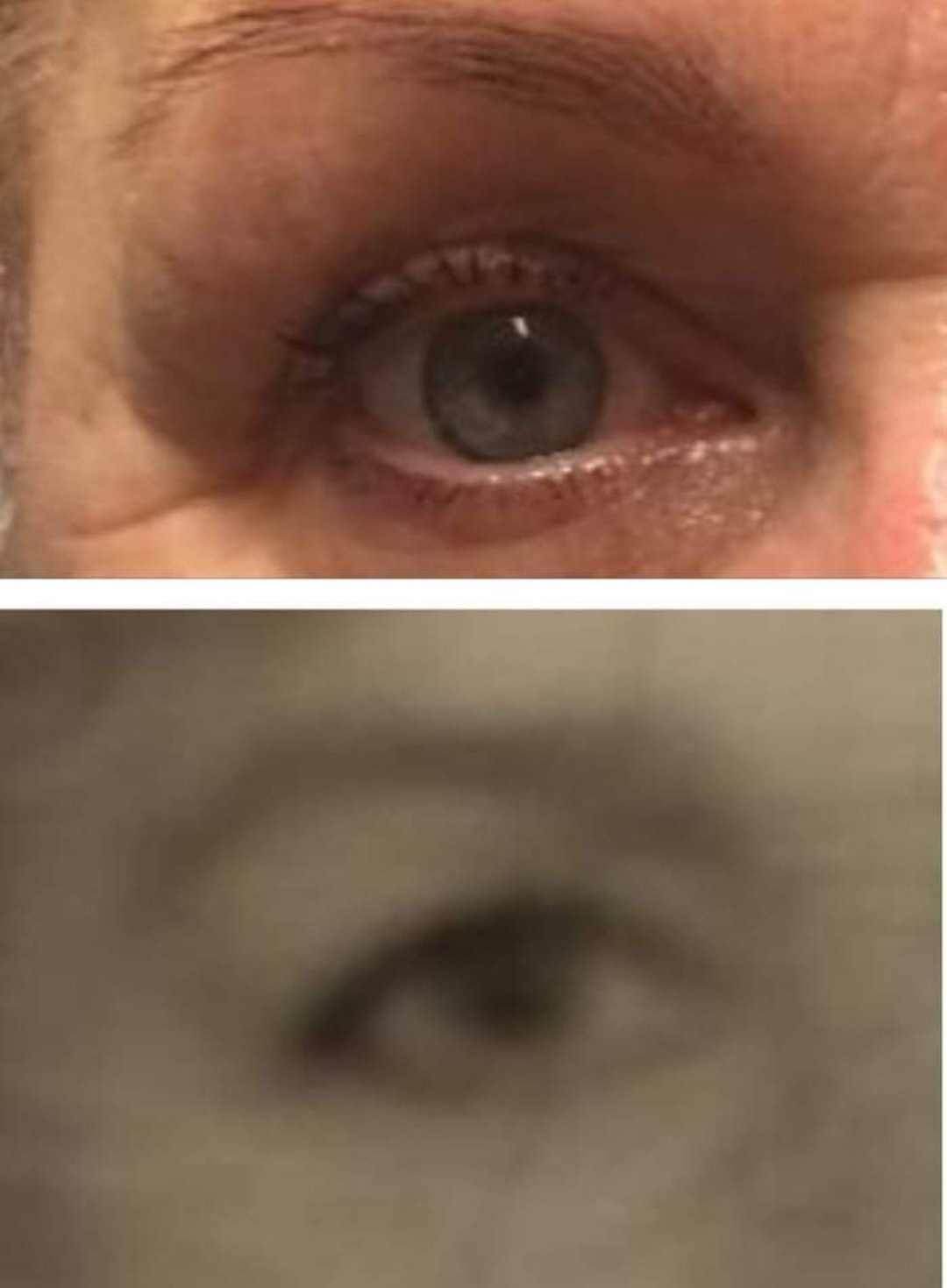 Zbliżenie na oko kobiety z widocznymi zmarszczkami wokół oka i delikatnie podkreślonymi rzęsami, poniżej niewyraźny obraz drugiego oka.