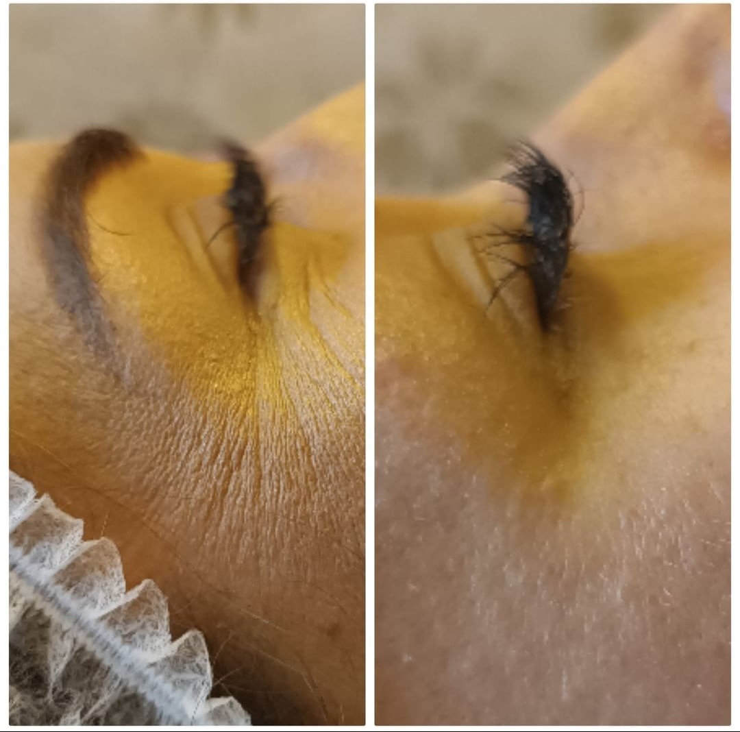 Zbliżenie na oko przedłużone sztucznymi rzęsami, widoczna skóra pod okiem z nałożonym preparatem przygotowującym do zabiegu, na głowie czepek ochronny.