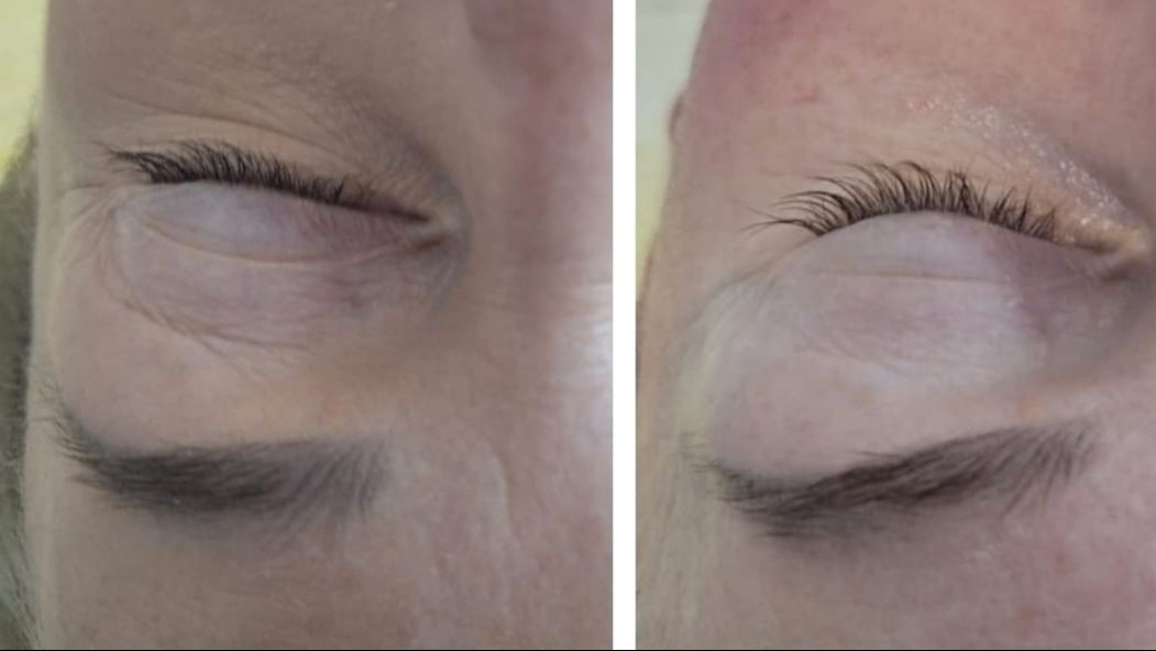 Porównanie oka przed i po zabiegu liftingu rzęs: widoczne wydłużone i podkręcone rzęsy po prawej stronie.