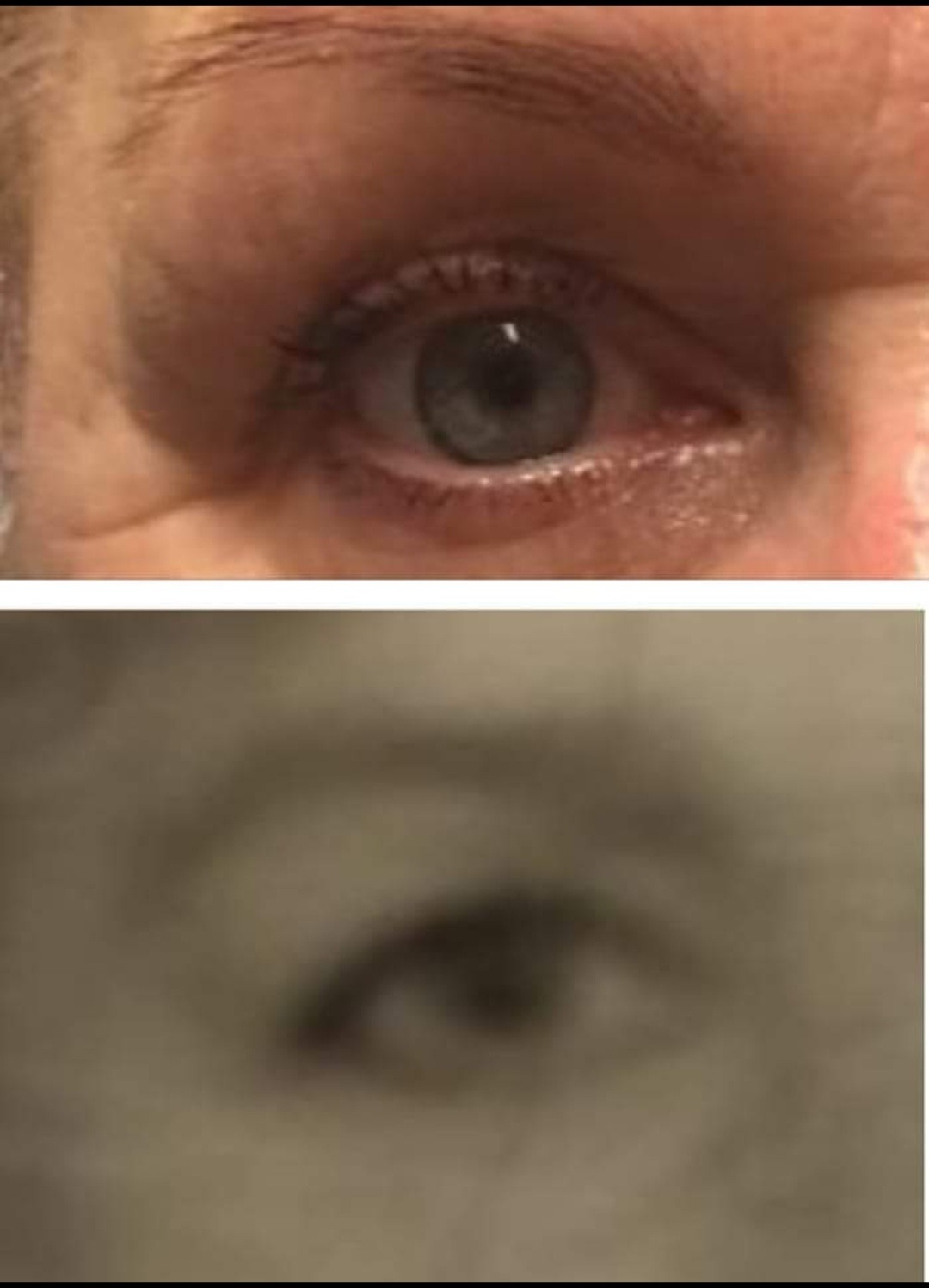 Zbliżenie na oko kobiety z widocznymi drobnymi zmarszczkami wokół, górna część zdjęcia jest ostra, dolna rozmazana i w sepii.