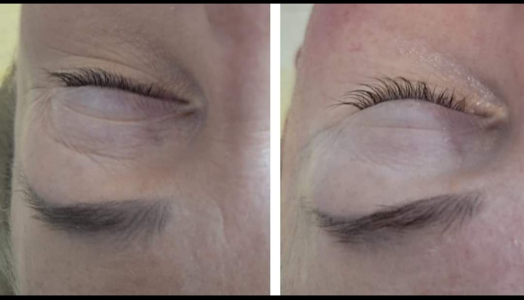 Porównanie wyglądu oka przed i po zabiegu: rzadsze rzęsy i zmarszczki przed, wydłużone i zagęszczone rzęsy po zabiegu.