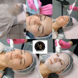 MK Beauty Marcelina Kopeć - Kolaż przedstawiający etapy zabiegów na twarz: nawilżanie parą, aplikacja serum, masaż urządzeniem z kulkami, nałożenie maski w płachcie. Modelka w czepku ochronnym leży na leżance kosmetycznej.