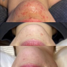 Manicure i pedicure Warszawa 1