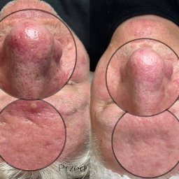 Manicure i pedicure Warszawa 2