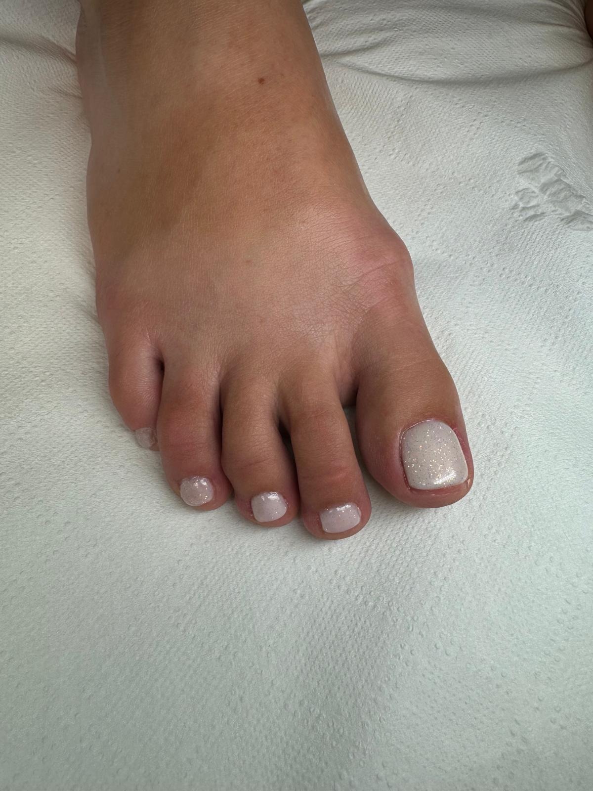 Pedicure z jasnym, opalizującym lakierem na stopie na tle białej, teksturowanej podkładki.