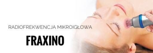 Zabieg radiofrekwencji mikroigłowej FRAXINO na policzku kobiety, widoczne urządzenie z niebieskim akcentem i zaczerwienienie skóry.