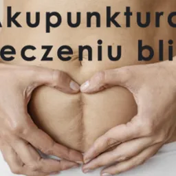 Brzuch kobiety z widoczną blizną po operacji, ręce ułożone w kształt serca na tle beżowej ściany.