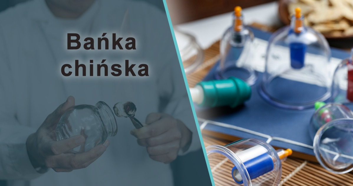 Zabiegi bańką chińska