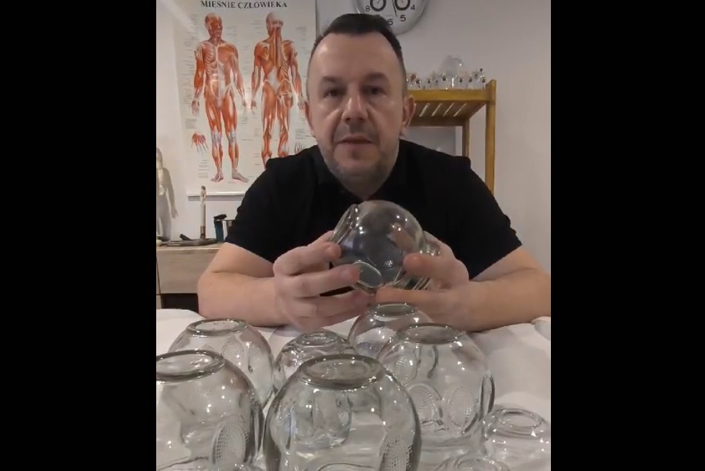 Zabiegi bańką chińską w gabinecie