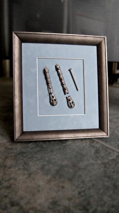 Oprawiona w ramkę kompozycja z dwóch metalowych płytek ortopedycznych, jedna z nich jest złamana, oraz śruby na błękitnym tle.