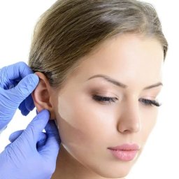 Art Clinik Kraków - Chirurgia Plastyczna - Medycyna Estetyczna - Kosmetologia - Kobieta podczas zabiegu korekcji uszu, dłonie w niebieskich rękawiczkach dotykają ucha, zbliżenie na profil twarzy, jasne tło.