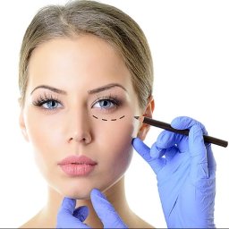 Art Clinik Kraków - Chirurgia Plastyczna - Medycyna Estetyczna - Kosmetologia - Kobieta z zaznaczonym obszarem pod okiem, przygotowywana do zabiegu, wykonywanym przez osobę w niebieskich rękawiczkach.