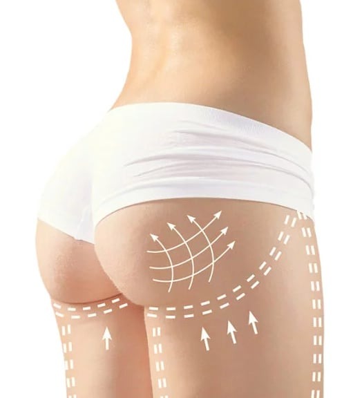 Kobieca sylwetka w białej bieliźnie z naniesionymi graficznie strzałkami i liniami sugerującymi modelowanie kształtu ud i pośladków.